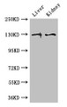 Western Blot, Positive WB detected in: Mouse liver tissue, Mouse kidney tissue, All lanes: PC antibody at 3ug/ml, Secondary, Goat polyclonal to rabbit IgG at 1/50000 dilution, Predicted band size: 130, 58 kDa, Observed band size: 130 kDa