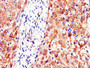 Immunohistochemistry of paraffin-embedded human liver tissue using CAC14647 at dilution of 1:100