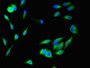 Immunofluorescent analysis of Hela cells using CAC14649 at dilution of 1:100 and Alexa Fluor 488-congugated AffiniPure Goat Anti-Rabbit IgG(H+L)