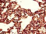 Immunohistochemistry of paraffin-embedded human lung tissue using CAC14655 at dilution of 1:100
