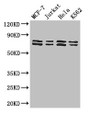 Western Blot, Positive WB detected in: MCF-7 whole cell lysate, Jurkat whole cell lysate, Hela whole cell lysate, K562 whole cell lysate, All lanes: TRIM25 antibody at 3ug/ml, Secondary, Goat polyclonal to rabbit IgG at 1/50000 dilution, Predicted band size: 71 kDa, Observed band size: 71, 80 kDa Western Blot, Positive WB detected in: MCF-7 whole cell lysate, Jurkat whole cell lysate, Hela whole cell lysate, K562 whole cell lysate, All lanes: TRIM25 antibody at 3ug/ml, Secondary, Goat polyclonal to rabbit IgG at 1/50000 dilution, Predicted band size: 71 kDa, Observed band size: 71, 80 kDa