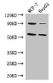 Western Blot, Positive WB detected in: MCF-7 whole cell lysate, HepG2 whole cell lysate, All lanes: FOXC1 antibody at 3ug/ml, Secondary, Goat polyclonal to rabbit IgG at 1/50000 dilution, Predicted band size: 57 kDa, Observed band size: 57 kDa Western Blot, Positive WB detected in: MCF-7 whole cell lysate, HepG2 whole cell lysate, All lanes: FOXC1 antibody at 3ug/ml, Secondary, Goat polyclonal to rabbit IgG at 1/50000 dilution, Predicted band size: 57 kDa, Observed band size: 57 kDa