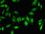 Immunofluorescent analysis of Hela cells using CAC14660 at dilution of 1:100 and Alexa Fluor 488-congugated AffiniPure Goat Anti-Rabbit IgG(H+L) Immunofluorescent analysis of Hela cells using CAC14660 at dilution of 1:100 and Alexa Fluor 488-congugated AffiniPure Goat Anti-Rabbit IgG(H+L)