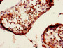 Immunohistochemistry of paraffin-embedded human testis tissue using CAC14667 at dilution of 1:100 Immunohistochemistry of paraffin-embedded human testis tissue using CAC14667 at dilution of 1:100