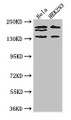 Western Blot, Positive WB detected in: Hela whole cell lysate, HEK293 whole cell lysate, All lanes: ITSN2 antibody at 4ug/ml, Secondary, Goat polyclonal to rabbit IgG at 1/50000 dilution, Predicted band size: 194, 191, 142, 136 kDa, Observed band size: 194, 191, 142 kDa Western Blot, Positive WB detected in: Hela whole cell lysate, HEK293 whole cell lysate, All lanes: ITSN2 antibody at 4ug/ml, Secondary, Goat polyclonal to rabbit IgG at 1/50000 dilution, Predicted band size: 194, 191, 142, 136 kDa, Observed band size: 194, 191, 142 kDa