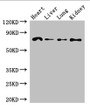 Western Blot, Positive WB detected in: Mouse heart tissue, Mouse liver tissue, Mouse lung tissue, Mouse kidney tissue, All lanes: FZD8 antibody at 2.7ug/ml, Secondary, Goat polyclonal to rabbit IgG at 1/50000 dilution, Predicted band size: 74 kDa, Observed band size: 74 kDa Western Blot, Positive WB detected in: Mouse heart tissue, Mouse liver tissue, Mouse lung tissue, Mouse kidney tissue, All lanes: FZD8 antibody at 2.7ug/ml, Secondary, Goat polyclonal to rabbit IgG at 1/50000 dilution, Predicted band size: 74 kDa, Observed band size: 74 kDa
