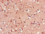 Immunohistochemistry of paraffin-embedded human brain tissue using CAC14669 at dilution of 1:100 Immunohistochemistry of paraffin-embedded human brain tissue using CAC14669 at dilution of 1:100