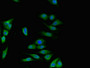Immunofluorescent analysis of Hela cells using CAC14671 at dilution of 1:100 and Alexa Fluor 488-congugated AffiniPure Goat Anti-Rabbit IgG(H+L) Immunofluorescent analysis of Hela cells using CAC14671 at dilution of 1:100 and Alexa Fluor 488-congugated AffiniPure Goat Anti-Rabbit IgG(H+L)