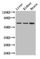 Western Blot, Positive WB detected in: Mouse liver tissue, Mouse kidney tissue, Mouse brain tissue, All lanes: AK5 antibody at 2.5ug/ml, Secondary, Goat polyclonal to rabbit IgG at 1/50000 dilution, Predicted band size: 64, 22, 61 kDa, Observed band size: 64 kDa Western Blot, Positive WB detected in: Mouse liver tissue, Mouse kidney tissue, Mouse brain tissue, All lanes: AK5 antibody at 2.5ug/ml, Secondary, Goat polyclonal to rabbit IgG at 1/50000 dilution, Predicted band size: 64, 22, 61 kDa, Observed band size: 64 kDa