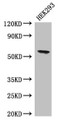 Western Blot, Positive WB detected in: HEK293 whole cell lysate, All lanes: BPI antibody at 4ug/ml, Secondary, Goat polyclonal to rabbit IgG at 1/50000 dilution, Predicted band size: 54 kDa, Observed band size: 54 kDa Western Blot, Positive WB detected in: HEK293 whole cell lysate, All lanes: BPI antibody at 4ug/ml, Secondary, Goat polyclonal to rabbit IgG at 1/50000 dilution, Predicted band size: 54 kDa, Observed band size: 54 kDa
