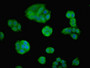 Immunofluorescent analysis of PC-3 cells using CAC14683 at dilution of 1:100 and Alexa Fluor 488-congugated AffiniPure Goat Anti-Rabbit IgG(H+L) Immunofluorescent analysis of PC-3 cells using CAC14683 at dilution of 1:100 and Alexa Fluor 488-congugated AffiniPure Goat Anti-Rabbit IgG(H+L)