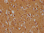 IHC image of CAC14688 diluted at 1:300 and staining in paraffin-embedded human brain tissue performed on a Leica BondTM system. After dewaxing and hydration, antigen retrieval was mediated by high pressure in a citrate buffer (pH 6.0). Section was blocked with 10% normal goat serum 30min at RT. Then primary antibody (1% BSA) was incubated at 4°C overnight. The primary is detected by a biotinylated secondary antibody and visualized using an HRP conjugated SP system. IHC image of CAC14688 diluted at 1:300 and staining in paraffin-embedded human brain tissue performed on a Leica BondTM system. After dewaxing and hydration, antigen retrieval was mediated by high pressure in a citrate buffer (pH 6.0). Section was blocked with 10% normal goat serum 30min at RT. Then primary antibody (1% BSA) was incubated at 4°C overnight. The primary is detected by a biotinylated secondary antibody and visualized using an HRP conjugated SP system.
