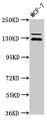 Western Blot, Positive WB detected in: MCF-7 whole cell lysate, All lanes: ZNF335 antibody at 3.5ug/ml, Secondary, Goat polyclonal to rabbit IgG at 1/50000 dilution, Predicted band size: 145, 130 kDa, Observed band size: 145, 130 kDa Western Blot, Positive WB detected in: MCF-7 whole cell lysate, All lanes: ZNF335 antibody at 3.5ug/ml, Secondary, Goat polyclonal to rabbit IgG at 1/50000 dilution, Predicted band size: 145, 130 kDa, Observed band size: 145, 130 kDa