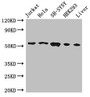Western Blot, Positive WB detected in: Jurkat whole cell lysate, Hela whole cell lysate, SH-SY5Y whole cell lysate, HEK293 whole cell lysate, Mouse liver tissue, All lanes: FKBP8 antibody at 3ug/ml, Secondary, Goat polyclonal to rabbit IgG at 1/50000 dilution, Predicted band size: 45, 28 kDa, Observed band size: 55 kDa Western Blot, Positive WB detected in: Jurkat whole cell lysate, Hela whole cell lysate, SH-SY5Y whole cell lysate, HEK293 whole cell lysate, Mouse liver tissue, All lanes: FKBP8 antibody at 3ug/ml, Secondary, Goat polyclonal to rabbit IgG at 1/50000 dilution, Predicted band size: 45, 28 kDa, Observed band size: 55 kDa