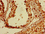 Immunohistochemistry of paraffin-embedded human testis tissue using CAC14694 at dilution of 1:100 Immunohistochemistry of paraffin-embedded human testis tissue using CAC14694 at dilution of 1:100