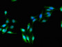 Immunofluorescent analysis of Hela cells using CAC14703 at dilution of 1:100 and Alexa Fluor 488-congugated AffiniPure Goat Anti-Rabbit IgG(H+L) Immunofluorescent analysis of Hela cells using CAC14703 at dilution of 1:100 and Alexa Fluor 488-congugated AffiniPure Goat Anti-Rabbit IgG(H+L)