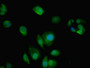 Immunofluorescent analysis of MCF-7 cells using CAC14704 at dilution of 1:100 and Alexa Fluor 488-congugated AffiniPure Goat Anti-Rabbit IgG(H+L) Immunofluorescent analysis of MCF-7 cells using CAC14704 at dilution of 1:100 and Alexa Fluor 488-congugated AffiniPure Goat Anti-Rabbit IgG(H+L)