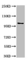 Western Blot, Positive WB detected in: U87 whole cell lysate, All lanes: AMPD2 antibody at 3ug/ml, Secondary, Goat polyclonal to rabbit IgG at 1/50000 dilution, Predicted band size: 101, 93, 89 kDa, Observed band size: 101 kDa Western Blot, Positive WB detected in: U87 whole cell lysate, All lanes: AMPD2 antibody at 3ug/ml, Secondary, Goat polyclonal to rabbit IgG at 1/50000 dilution, Predicted band size: 101, 93, 89 kDa, Observed band size: 101 kDa