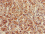 Immunohistochemistry of paraffin-embedded human adrenal gland tissue using CAC14707 at dilution of 1:100 Immunohistochemistry of paraffin-embedded human adrenal gland tissue using CAC14707 at dilution of 1:100