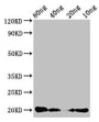 Western Blot, Positive WB detected in Recombinant protein, All lanes: CALCA antibody at 3ug/ml, Secondary, Goat polyclonal to rabbit IgG at 1/50000 dilution, Predicted band size: 20 kDa, Observed band size: 20 kDa Western Blot, Positive WB detected in Recombinant protein, All lanes: CALCA antibody at 3ug/ml, Secondary, Goat polyclonal to rabbit IgG at 1/50000 dilution, Predicted band size: 20 kDa, Observed band size: 20 kDa