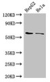 Western Blot, Positive WB detected in: HepG2 whole cell lysate, Hela whole cell lysate, All lanes: CDT1 antibody at 3ug/ml, Secondary, Goat polyclonal to rabbit IgG at 1/50000 dilution, Predicted band size: 61 kDa, Observed band size: 61 kDa Western Blot, Positive WB detected in: HepG2 whole cell lysate, Hela whole cell lysate, All lanes: CDT1 antibody at 3ug/ml, Secondary, Goat polyclonal to rabbit IgG at 1/50000 dilution, Predicted band size: 61 kDa, Observed band size: 61 kDa