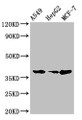 Western Blot, Positive WB detected in: A549 whole cell lysate, HepG2 whole cell lysate, MCF-7 whole cell lysate, All lanes: CEBPA antibody at 2ug/ml, Secondary, Goat polyclonal to rabbit IgG at 1/50000 dilution, Predicted band size: 38, 36, 26, 42 kDa, Observed band size: 38 kDa