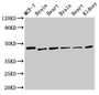 Western Blot, Positive WB detected in: MCF-7 whole cell lysate, Rat brain tissue, Rat heart tissue, Mouse brain tissue, Mouse heart tissue, Mouse kidney tissue, All lanes: DKC1 antibody at 2.5ug/ml, Secondary, Goat polyclonal to rabbit IgG at 1/50000 dilution, Predicted band size: 58, 48 kDa, Observed band size: 48 kDa Western Blot, Positive WB detected in: MCF-7 whole cell lysate, Rat brain tissue, Rat heart tissue, Mouse brain tissue, Mouse heart tissue, Mouse kidney tissue, All lanes: DKC1 antibody at 2.5ug/ml, Secondary, Goat polyclonal to rabbit IgG at 1/50000 dilution, Predicted band size: 58, 48 kDa, Observed band size: 48 kDa