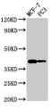 Western Blot, Positive WB detected in: MCF-7 whole cell lysate, PC-3 whole cell lysate, All lanes: DNASE2 antibody at 2.7ug/ml, Secondary, Goat polyclonal to rabbit IgG at 1/50000 dilution, Predicted band size: 40, 34 kDa, Observed band size: 40 kDa Western Blot, Positive WB detected in: MCF-7 whole cell lysate, PC-3 whole cell lysate, All lanes: DNASE2 antibody at 2.7ug/ml, Secondary, Goat polyclonal to rabbit IgG at 1/50000 dilution, Predicted band size: 40, 34 kDa, Observed band size: 40 kDa