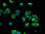 Immunofluorescent analysis of HepG2 cells using CAC14724 at dilution of 1:100 and Alexa Fluor 488-congugated AffiniPure Goat Anti-Rabbit IgG(H+L) Immunofluorescent analysis of HepG2 cells using CAC14724 at dilution of 1:100 and Alexa Fluor 488-congugated AffiniPure Goat Anti-Rabbit IgG(H+L)
