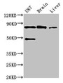 Western Blot, Positive WB detected in: U87 whole cell lysate, Mouse brain tissue, Mouse liver tissue, All lanes: GARS antibody at 3ug/ml, Secondary, Goat polyclonal to rabbit IgG at 1/50000 dilution, Predicted band size: 84 kDa, Observed band size: 84 kDa Western Blot, Positive WB detected in: U87 whole cell lysate, Mouse brain tissue, Mouse liver tissue, All lanes: GARS antibody at 3ug/ml, Secondary, Goat polyclonal to rabbit IgG at 1/50000 dilution, Predicted band size: 84 kDa, Observed band size: 84 kDa