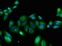 Immunofluorescent analysis of HepG2 cells using CAC14733 at dilution of 1:100 and Alexa Fluor 488-congugated AffiniPure Goat Anti-Rabbit IgG(H+L) Immunofluorescent analysis of HepG2 cells using CAC14733 at dilution of 1:100 and Alexa Fluor 488-congugated AffiniPure Goat Anti-Rabbit IgG(H+L)