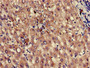 Immunohistochemistry of paraffin-embedded human liver tissue using CAC14735 at dilution of 1:100 Immunohistochemistry of paraffin-embedded human liver tissue using CAC14735 at dilution of 1:100