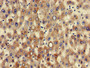 Immunohistochemistry of paraffin-embedded human liver tissue using CAC14736 at dilution of 1:100 Immunohistochemistry of paraffin-embedded human liver tissue using CAC14736 at dilution of 1:100