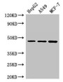 Western Blot, Positive WB detected in: HepG2 whole cell lysate, A549 whole cell lysate, MCF-7 whole cell lysate, All lanes: MAEA antibody at 3ug/ml, Secondary, Goat polyclonal to rabbit IgG at 1/50000 dilution, Predicted band size: 46, 41, 37, 27 kDa, Observed band size: 46 kDa Western Blot, Positive WB detected in: HepG2 whole cell lysate, A549 whole cell lysate, MCF-7 whole cell lysate, All lanes: MAEA antibody at 3ug/ml, Secondary, Goat polyclonal to rabbit IgG at 1/50000 dilution, Predicted band size: 46, 41, 37, 27 kDa, Observed band size: 46 kDa