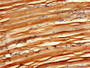 IHC image of CAC14737 diluted at 1:600 and staining in paraffin-embedded human skeletal muscle tissue performed on a Leica BondTM system. After dewaxing and hydration, antigen retrieval was mediated by high pressure in a citrate buffer (pH 6.0). Section was blocked with 10% normal goat serum 30min at RT. Then primary antibody (1% BSA) was incubated at 4°C overnight. The primary is detected by a biotinylated secondary antibody and visualized using an HRP conjugated SP system. IHC image of CAC14737 diluted at 1:600 and staining in paraffin-embedded human skeletal muscle tissue performed on a Leica BondTM system. After dewaxing and hydration, antigen retrieval was mediated by high pressure in a citrate buffer (pH 6.0). Section was blocked with 10% normal goat serum 30min at RT. Then primary antibody (1% BSA) was incubated at 4°C overnight. The primary is detected by a biotinylated secondary antibody and visualized using an HRP conjugated SP system.