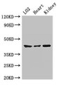 Western Blot, Positive WB detected in: LO2 whole cell lysate, Mouse heart tissue, Mouse kidney tissue, All lanes: MAP2K1 antibody at 2ug/ml, Secondary, Goat polyclonal to rabbit IgG at 1/50000 dilution, Predicted band size: 44, 41 kDa, Observed band size: 44 kDa Western Blot, Positive WB detected in: LO2 whole cell lysate, Mouse heart tissue, Mouse kidney tissue, All lanes: MAP2K1 antibody at 2ug/ml, Secondary, Goat polyclonal to rabbit IgG at 1/50000 dilution, Predicted band size: 44, 41 kDa, Observed band size: 44 kDa