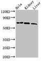Western Blot, Positive WB detected in: Hela whole cell lysate, Mouse kidney tissue, Mouse liver tissue, All lanes: MLPH antibody at 3ug/ml, Secondary, Goat polyclonal to rabbit IgG at 1/50000 dilution, Predicted band size: 66, 63, 53, 61, 51 kDa, Observed band size: 66 kDa Western Blot, Positive WB detected in: Hela whole cell lysate, Mouse kidney tissue, Mouse liver tissue, All lanes: MLPH antibody at 3ug/ml, Secondary, Goat polyclonal to rabbit IgG at 1/50000 dilution, Predicted band size: 66, 63, 53, 61, 51 kDa, Observed band size: 66 kDa
