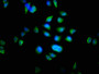 Immunofluorescence staining of Hela cells with CAC14741 at 1:100, counter-stained with DAPI. The cells were fixed in 4% formaldehyde, permeabilized using 0.2% Triton X-100 and blocked in 10% normal Goat Serum. The cells were then incubated with the antibody overnight at 4°C. The secondary antibody was Alexa Fluor 488-congugated AffiniPure Goat Anti-Rabbit IgG(H+L). Immunofluorescence staining of Hela cells with CAC14741 at 1:100, counter-stained with DAPI. The cells were fixed in 4% formaldehyde, permeabilized using 0.2% Triton X-100 and blocked in 10% normal Goat Serum. The cells were then incubated with the antibody overnight at 4°C. The secondary antibody was Alexa Fluor 488-congugated AffiniPure Goat Anti-Rabbit IgG(H+L).