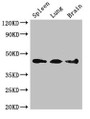Western Blot, Positive WB detected in: Mouse spleen tissue, Mouse lung tissue, Mouse brain tissue, All lanes: NCF1 antibody at 3ug/ml, Secondary, Goat polyclonal to rabbit IgG at 1/50000 dilution, Predicted band size: 45, 31 kDa, Observed band size: 45 kDa Western Blot, Positive WB detected in: Mouse spleen tissue, Mouse lung tissue, Mouse brain tissue, All lanes: NCF1 antibody at 3ug/ml, Secondary, Goat polyclonal to rabbit IgG at 1/50000 dilution, Predicted band size: 45, 31 kDa, Observed band size: 45 kDa