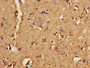 Immunohistochemistry of paraffin-embedded human brain tissue using CAC14745 at dilution of 1:100