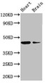 Western Blot, Positive WB detected in: Mouse heart tissue, Mouse brain tissue, All lanes: P2RX1 antibody at 3ug/ml, Secondary, Goat polyclonal to rabbit IgG at 1/50000 dilution, Predicted band size: 45 kDa, Observed band size: 45 kDa