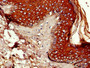 Immunohistochemistry of paraffin-embedded human skin tissue using CAC14746 at dilution of 1:100 Immunohistochemistry of paraffin-embedded human skin tissue using CAC14746 at dilution of 1:100