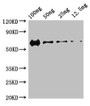 Western Blot, Positive WB detected in Recombinant protein, All lanes: PRKDC antibody at 3ug/ml, Secondary, Goat polyclonal to rabbit IgG at 1/50000 dilution, predicted band size: 60 kDa, observed band size: 60 kDa Western Blot, Positive WB detected in Recombinant protein, All lanes: PRKDC antibody at 3ug/ml, Secondary, Goat polyclonal to rabbit IgG at 1/50000 dilution, predicted band size: 60 kDa, observed band size: 60 kDa