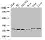 Western Blot, Positive WB detected in: A549 whole cell lysate, PC-3 whole cell lysate, NIH/3T3 whole cell lysate, Hela whole cell lysate, Rat lung tissue, Mouse liver tissue, All lanes: PSMA3 antibody at 2.7ug/ml, Secondary, Goat polyclonal to rabbit IgG at 1/50000 dilution, Predicted band size: 29, 28 kDa, Observed band size: 29 kDa Western Blot, Positive WB detected in: A549 whole cell lysate, PC-3 whole cell lysate, NIH/3T3 whole cell lysate, Hela whole cell lysate, Rat lung tissue, Mouse liver tissue, All lanes: PSMA3 antibody at 2.7ug/ml, Secondary, Goat polyclonal to rabbit IgG at 1/50000 dilution, Predicted band size: 29, 28 kDa, Observed band size: 29 kDa