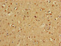 Immunohistochemistry of paraffin-embedded human brain tissue using CAC14753 at dilution of 1:100 Immunohistochemistry of paraffin-embedded human brain tissue using CAC14753 at dilution of 1:100