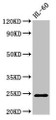 Western Blot, Positive WB detected in: HL60 whole cell lysate, All lanes: RAB5A antibody at 2.7ug/ml, Secondary, Goat polyclonal to rabbit IgG at 1/50000 dilution, Predicted band size: 24, 23 kDa, Observed band size: 24 kDa Western Blot, Positive WB detected in: HL60 whole cell lysate, All lanes: RAB5A antibody at 2.7ug/ml, Secondary, Goat polyclonal to rabbit IgG at 1/50000 dilution, Predicted band size: 24, 23 kDa, Observed band size: 24 kDa