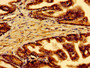 Immunohistochemistry of paraffin-embedded human prostate tissue using CAC14754 at dilution of 1:100 Immunohistochemistry of paraffin-embedded human prostate tissue using CAC14754 at dilution of 1:100