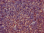 Immunohistochemistry of paraffin-embedded human lymph node tissue using CAC14756 at dilution of 1:100 Immunohistochemistry of paraffin-embedded human lymph node tissue using CAC14756 at dilution of 1:100