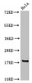 Western Blot, Positive WB detected in: Hela whole cell lysate, All lanes: RPS15 antibody at 4ug/ml, Secondary, Goat polyclonal to rabbit IgG at 1/50000 dilution, Predicted band size: 18 kDa, Observed band size: 18 kDa Western Blot, Positive WB detected in: Hela whole cell lysate, All lanes: RPS15 antibody at 4ug/ml, Secondary, Goat polyclonal to rabbit IgG at 1/50000 dilution, Predicted band size: 18 kDa, Observed band size: 18 kDa