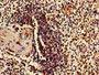 Immunohistochemistry of paraffin-embedded human spleen tissue using CAC14757 at dilution of 1:100 Immunohistochemistry of paraffin-embedded human spleen tissue using CAC14757 at dilution of 1:100